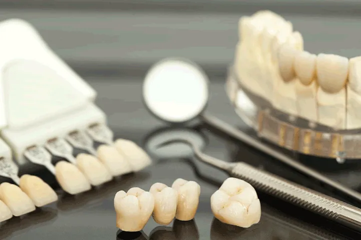 dental bridge concept on the table