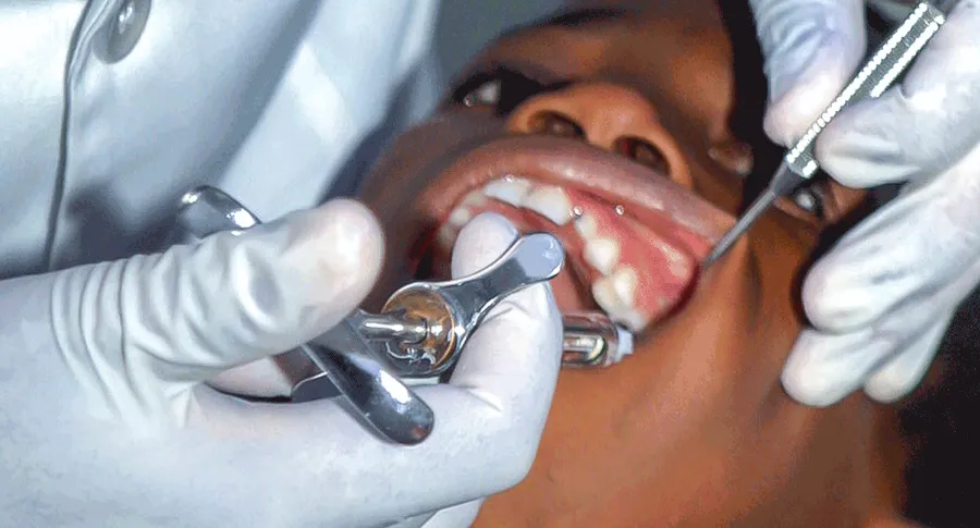 closeup open mouth at the dentist