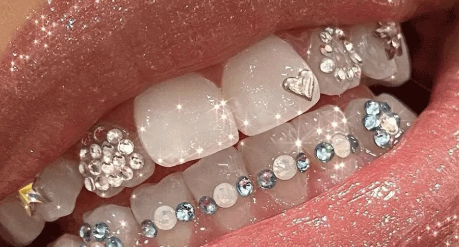 smiling teeth with jewellery