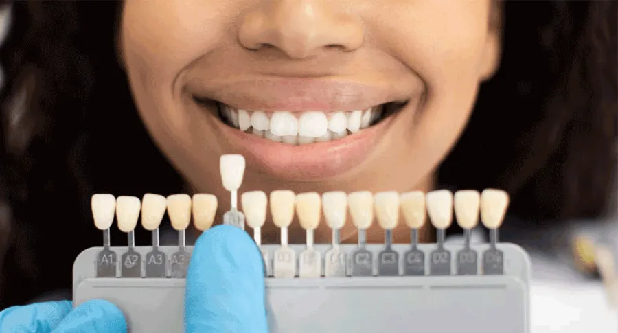 veneer sampling process