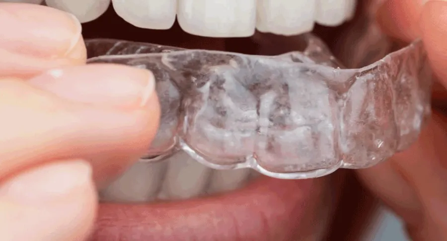 mouth closeup earing night guards