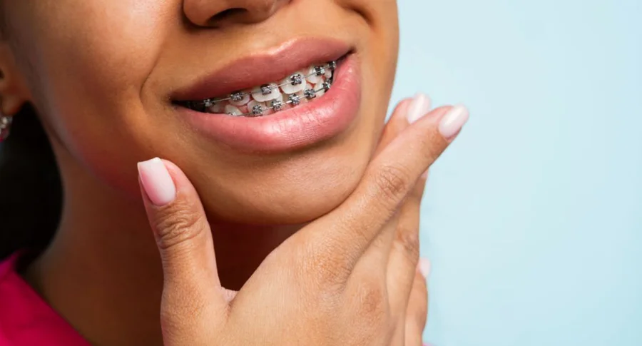 woman smiling with braces