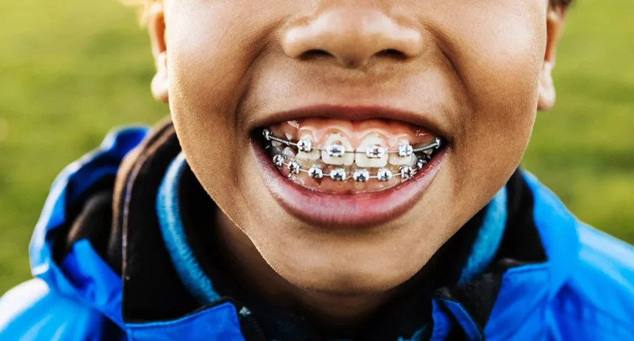 girl smiling with braces