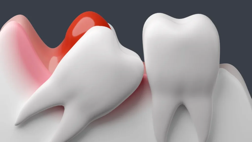 red tooth and white tooth